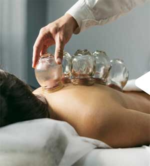 Cupping Service